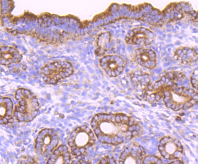 Anti-CD39 Antibody (8G885)