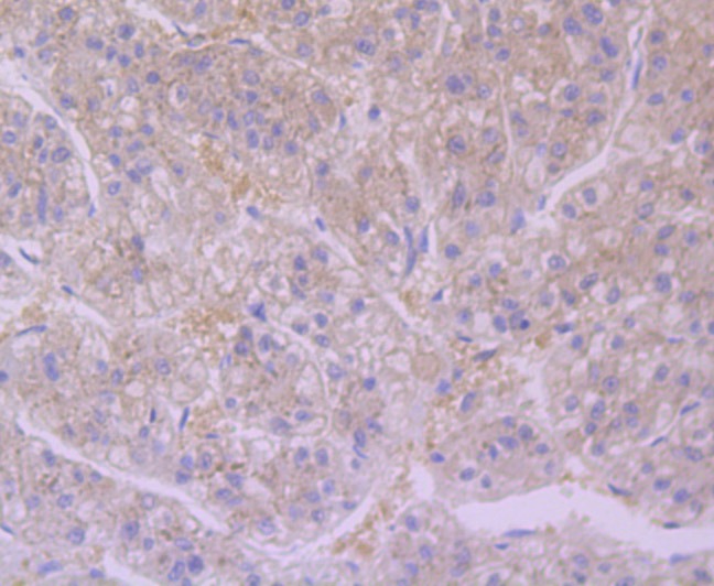 Anti-FURIN Antibody (5P939)