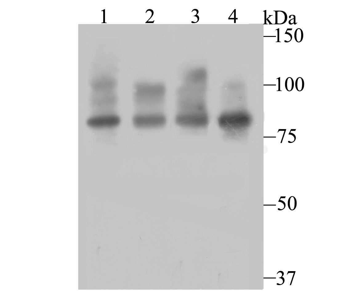 Anti-FURIN Antibody (5P939)