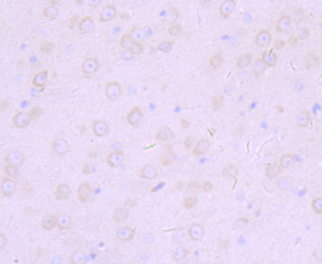 Anti-FURIN Antibody (5P939)