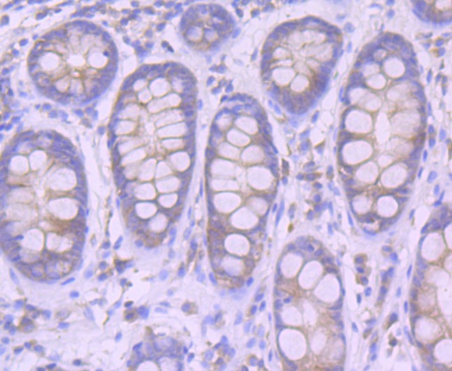 Anti-FURIN Antibody (5P939)