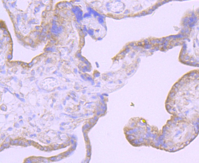 Anti-FURIN Antibody (5P939)