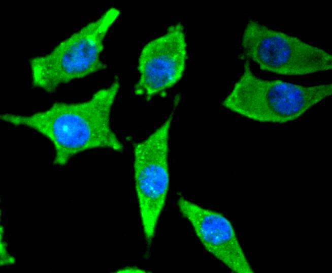 Anti-Tyrosine Hydroxylase Antibody (9P45)