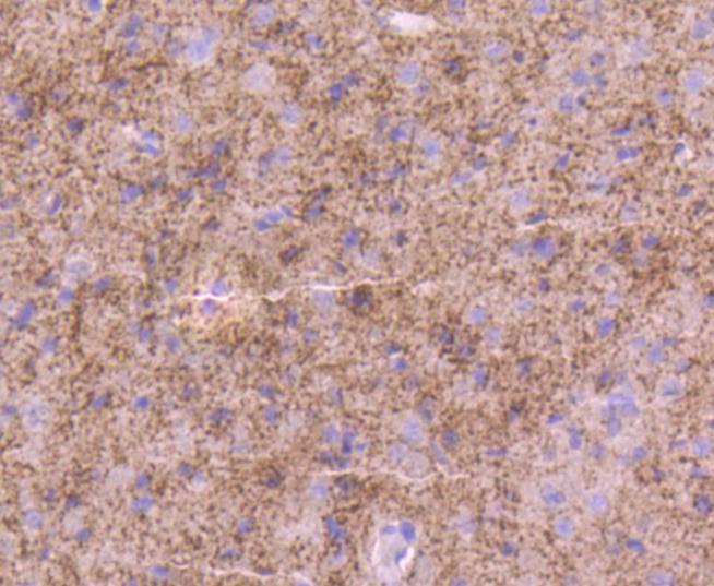 Anti-Tyrosine Hydroxylase Antibody (9P45)