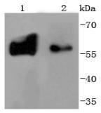 Anti-Tyrosine Hydroxylase Antibody (9P45)