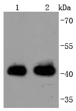 Anti-HLA-A Antibody (2M442)