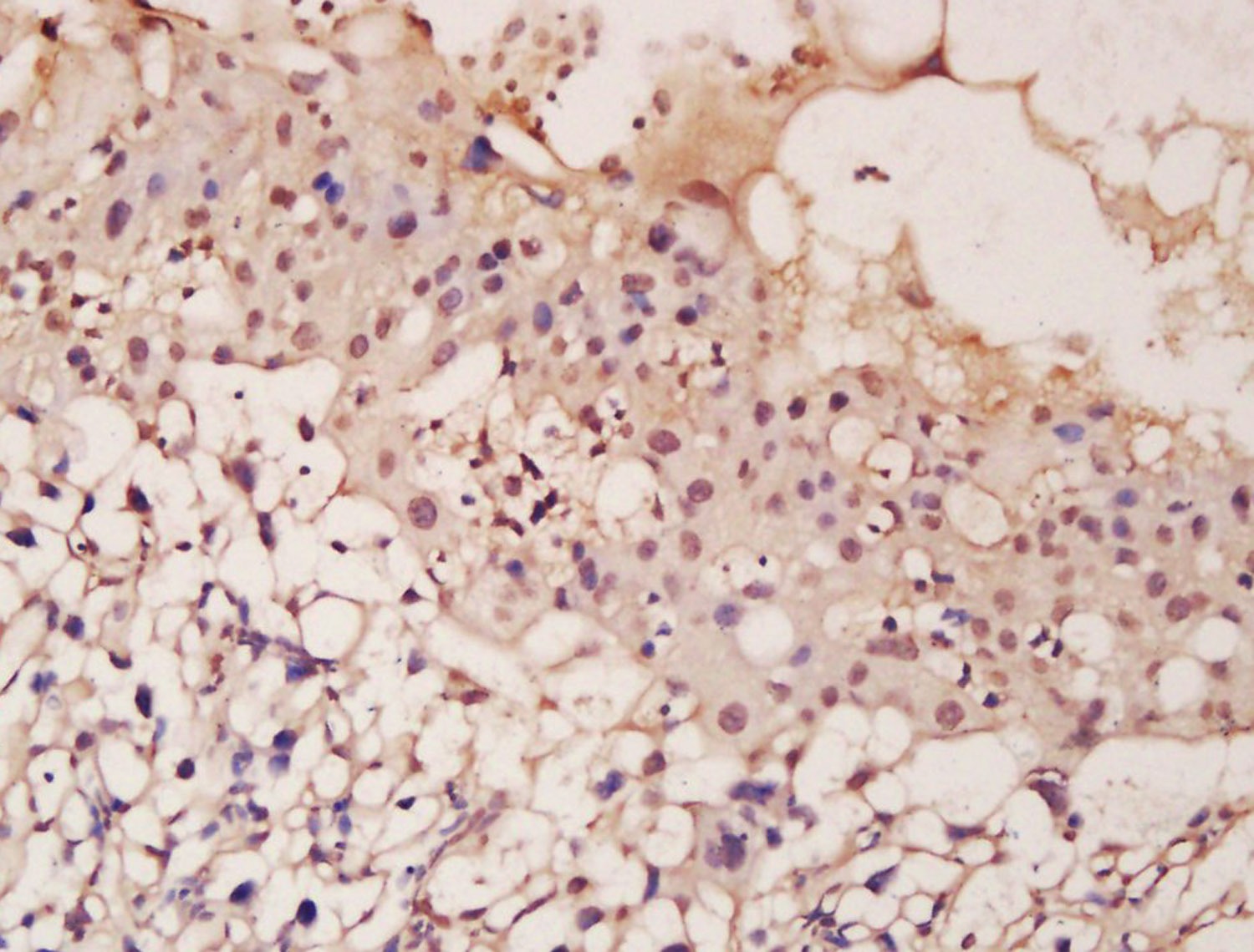 Anti-ASCL2 Polyclonal Antibody
