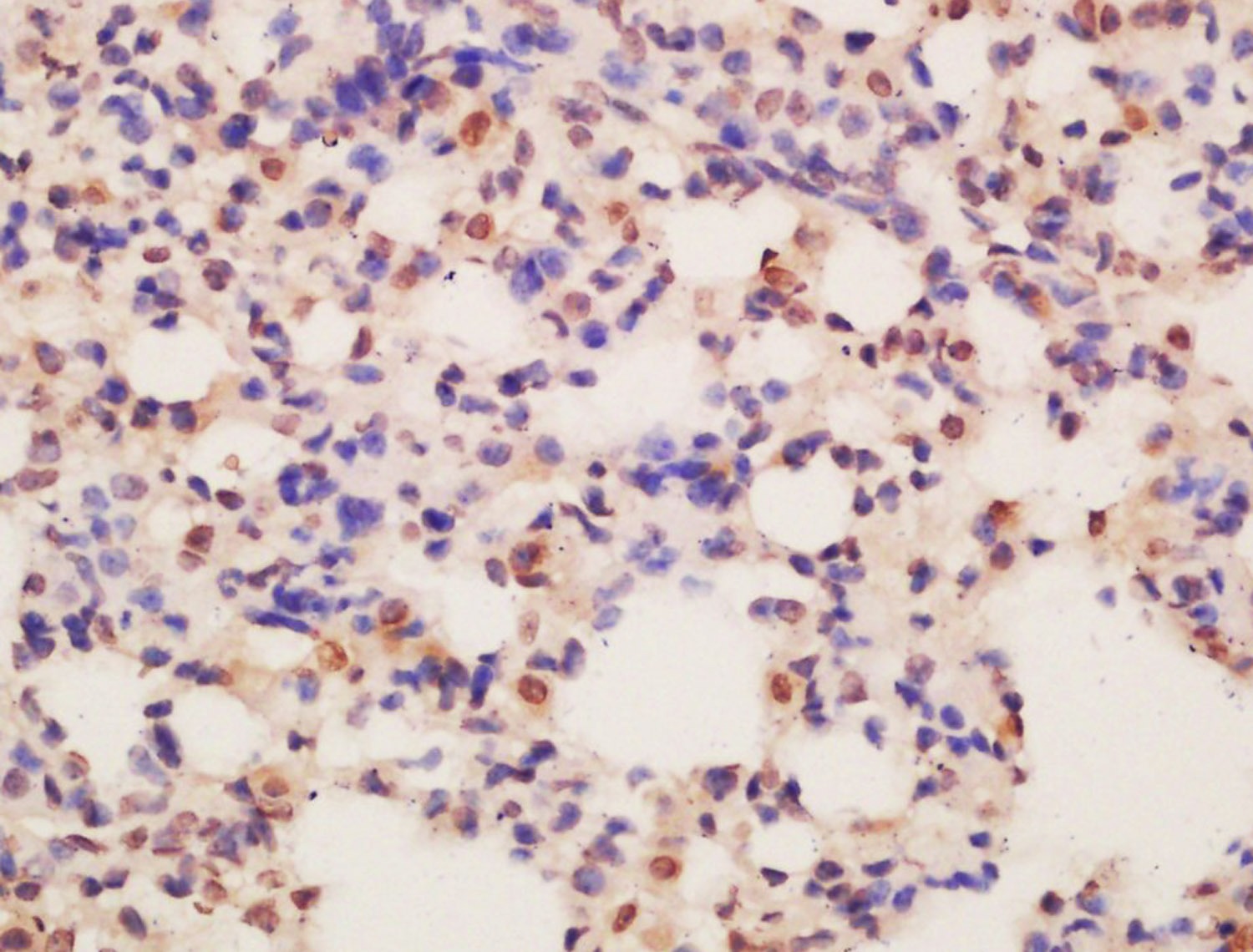 Anti-ASCL2 Polyclonal Antibody
