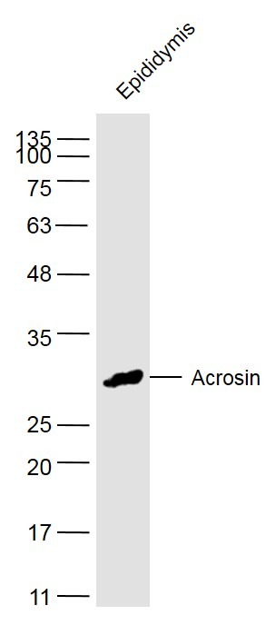 Anti-Acrosin Polyclonal Antibody