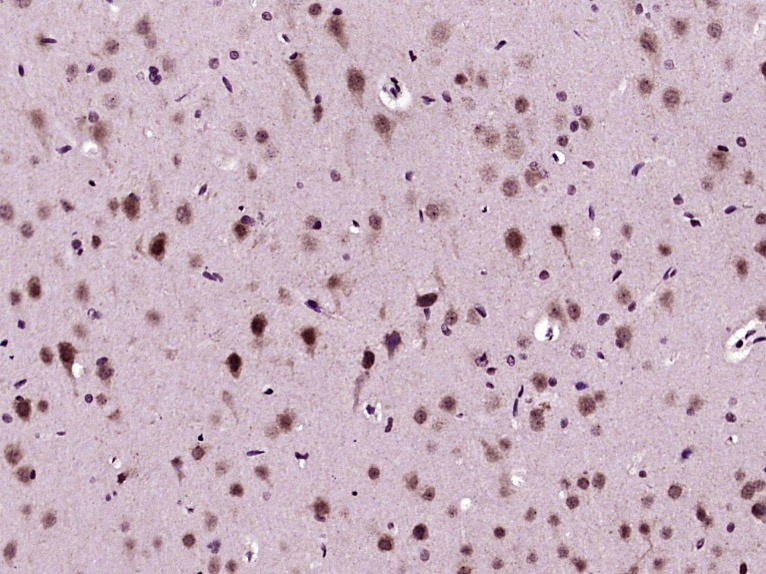 Anti-Phospho-Akt (Thr308) Polyclonal Antibody