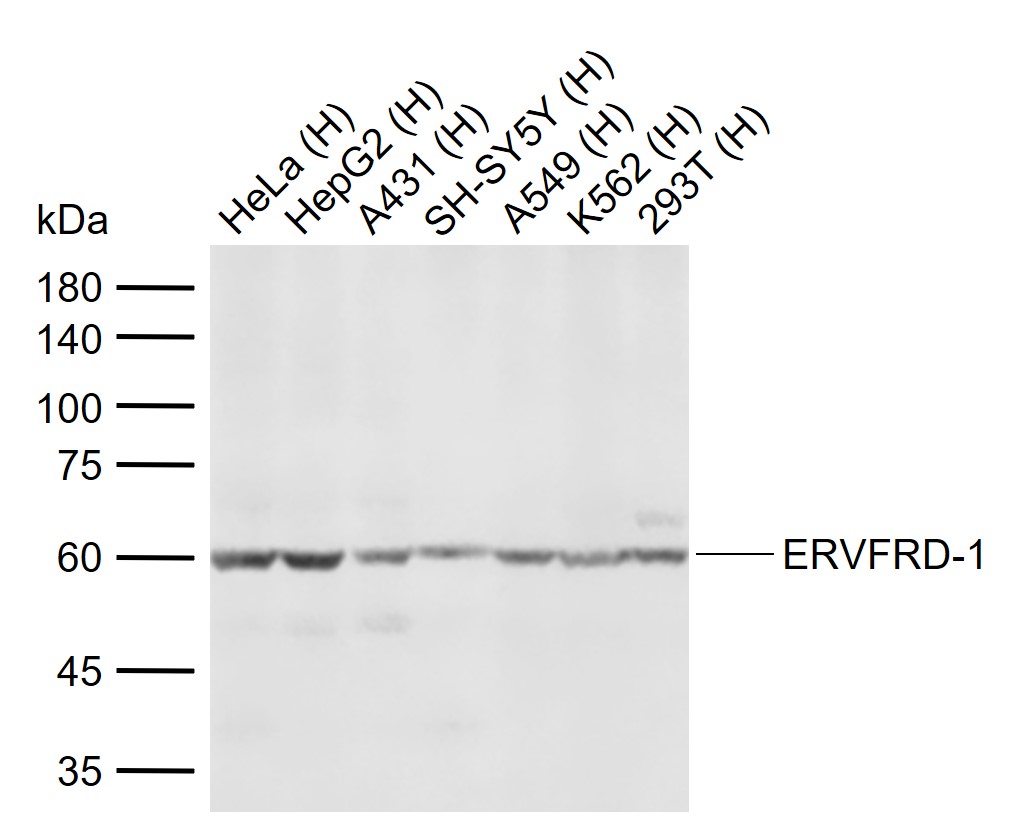 Anti-ERVFRD-1 Polyclonal Antibody
