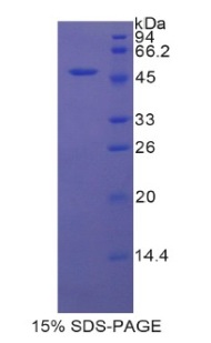 Protease, Serine 8