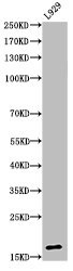Histone H3, acetylated