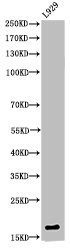 Histone H3, acetylated