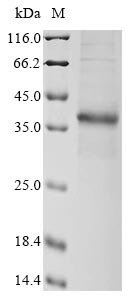 GFP-like Non-fluorescent Chromoprotein FP595, Recombinant, Anemonia sulcata, aa1-62, hFC-Tag