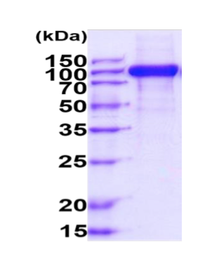 CSF1R, Recombinant, Human, aa20-517, hIgG-His-Tag