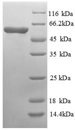 CYS4, Recombinant, Saccharomyces Cerevisiae, aa1-507, His-Tag
