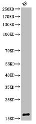 Histone H3, acetylated