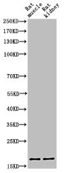 Histone H3, acetylated