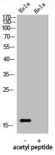 Histone H3, acetylated