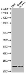 Histone H3, acetylated