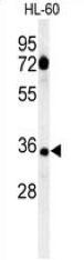 CD80, CT