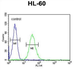 CD80, CT