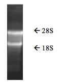 Tissue, Total RNA, Human Adult Normal, Bone Marrow, BioGenomics™