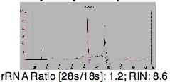 Tissue, Total RNA, Human Adult Normal, Bone Marrow, BioGenomics™