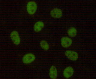 DNA-PKcs
