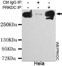 DNA-PKcs