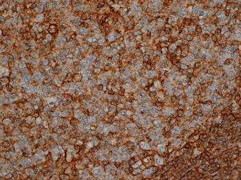 CD44