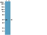Histone H1, phosphorylated