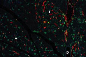 Lycopersicon esculentum Lectin