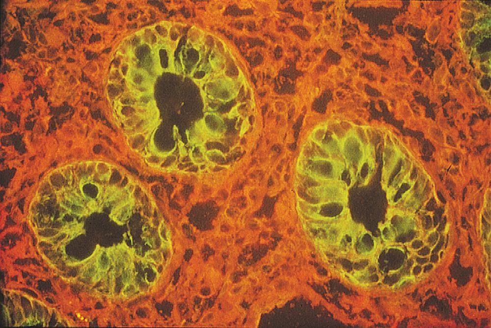 Lycopersicon esculentum Lectin