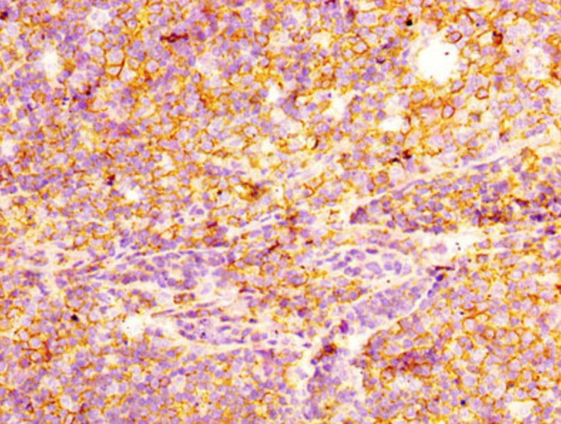 CD44
