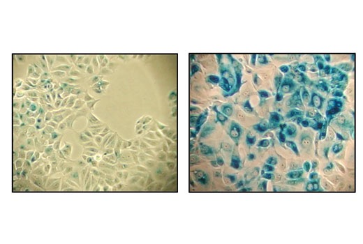 β-Galactosidase Staining Kit, BioAssay™