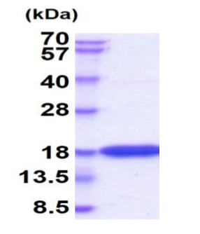 IFNG, Recombinant, Human, aa24-161, His-Tag