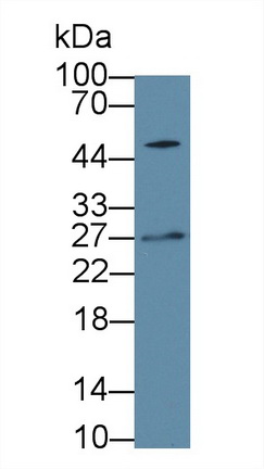 Immunoglobulin Lambda 2