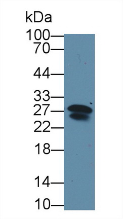 Immunoglobulin Lambda 2