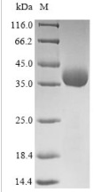 Outer Capsid Protein VP4, Recombinant, Rotavirus X, aa1-249, His-tag