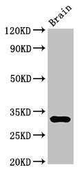 DNASE1