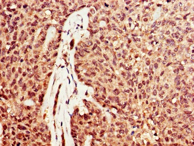 DNASE1