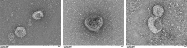 Cell Supernatant Exosome Isolation BioAssay™ Kit