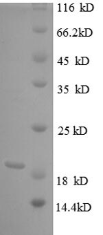 TNF, Recombinant, Bovine, aa74-234, His-Tag