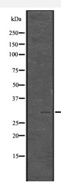 Histone H1.3, phosphorylated