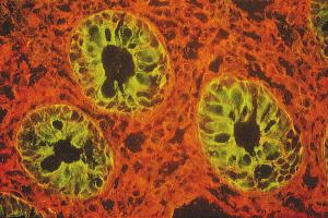 Lycopersicon esculentum Lectin