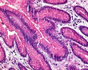 Hematoxylin Certified for Microscopy, 80+% Dye Content