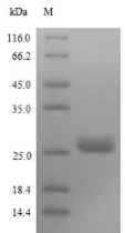 Matrix Protein, Recombinant, Rabies Virus, aa1-202, His-tag, Myc-tag