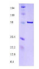 Parvovirus Capsid Protein 2, Recombinant, His-Tag